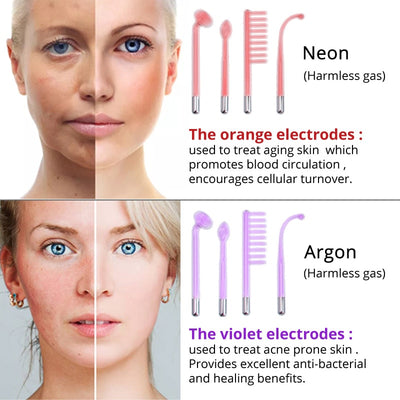 Violet Ray Acne Remover