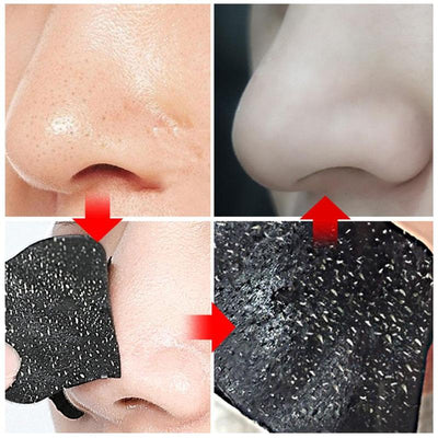 Blackhead Remover Nose Mask