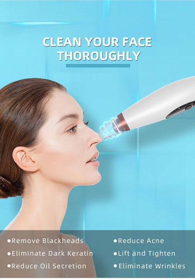 Blackhead Remover Tool