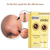 Charcoal Blackhead Remove Face Masks