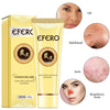 Charcoal Blackhead Remove Face Masks