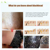 Charcoal Blackhead Remove Face Masks