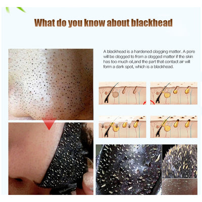 Charcoal Blackhead Remove Face Masks