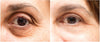 Anti-aging Face Massager