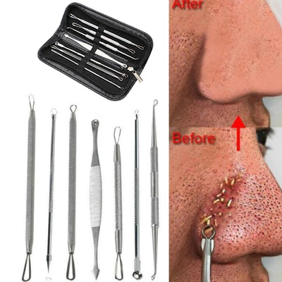 Stainless Steel Blackhead Remover